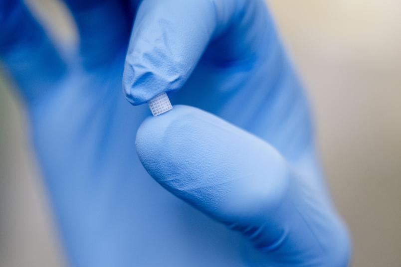 Nahaufnahme einer Hand mit blauem Schutzhandschuh, die ein extrem kleines, gitterartig strukturiertes Plättchen (Mikrochip) präsentiert. Der Hintergrund ist unscharf.