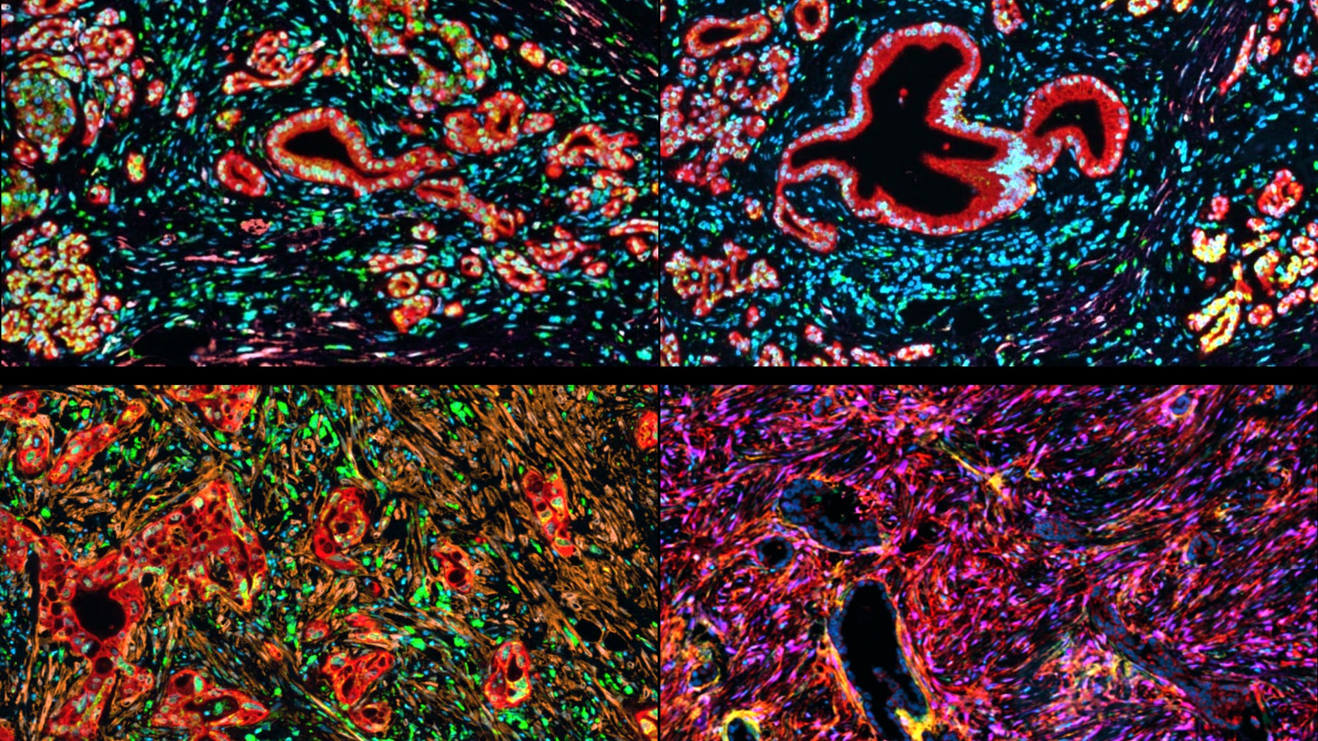 Eine vierteilige Collage aus hochauflösenden Fluoreszenzmikroskopie-Aufnahmen von Gewebeproben.